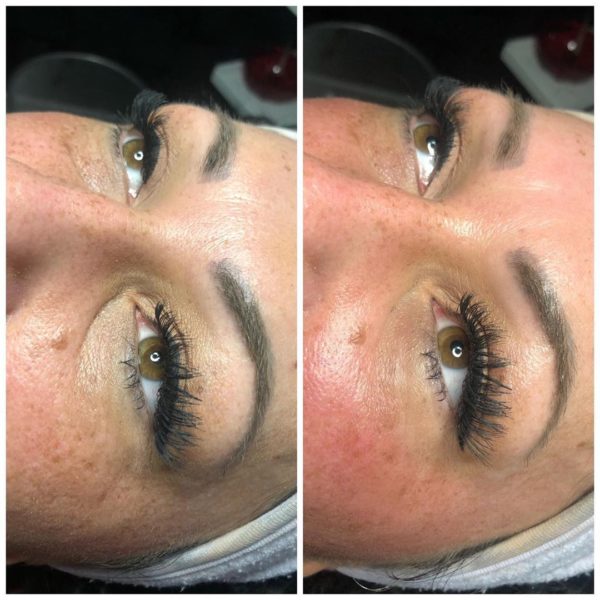 3 – wöchige Facelifting-Kur mit ProCea